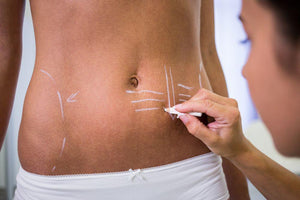 ¿Qué diferencia hay entre cirugía plástica y estética?