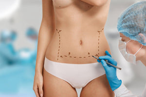 ¿Cómo darle forma al ombligo después de tu abdominoplastia?